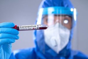 científico sosteniendo una muestra de sangre positiva de covid-19